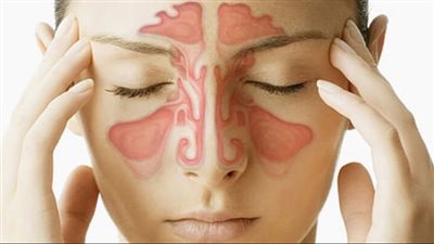 علاج الجيوب الأنفية في المنزل بـ 8 مكونات داخل دولاب مطبخك